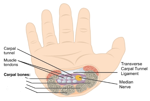 Carpal Tunnel Master