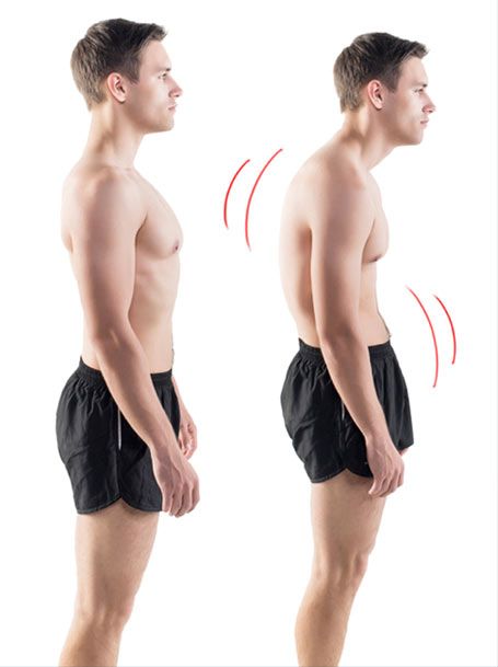 Forward Head Posture Fix Reviews