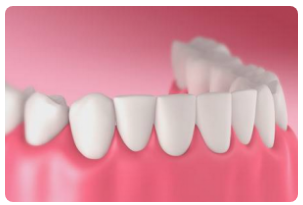 Home Dental Solutions pdf