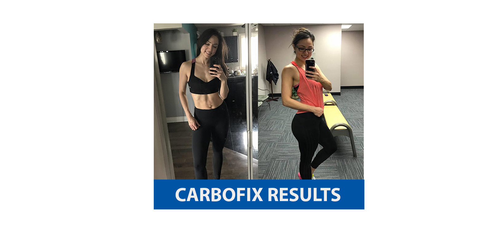 Carbofix results