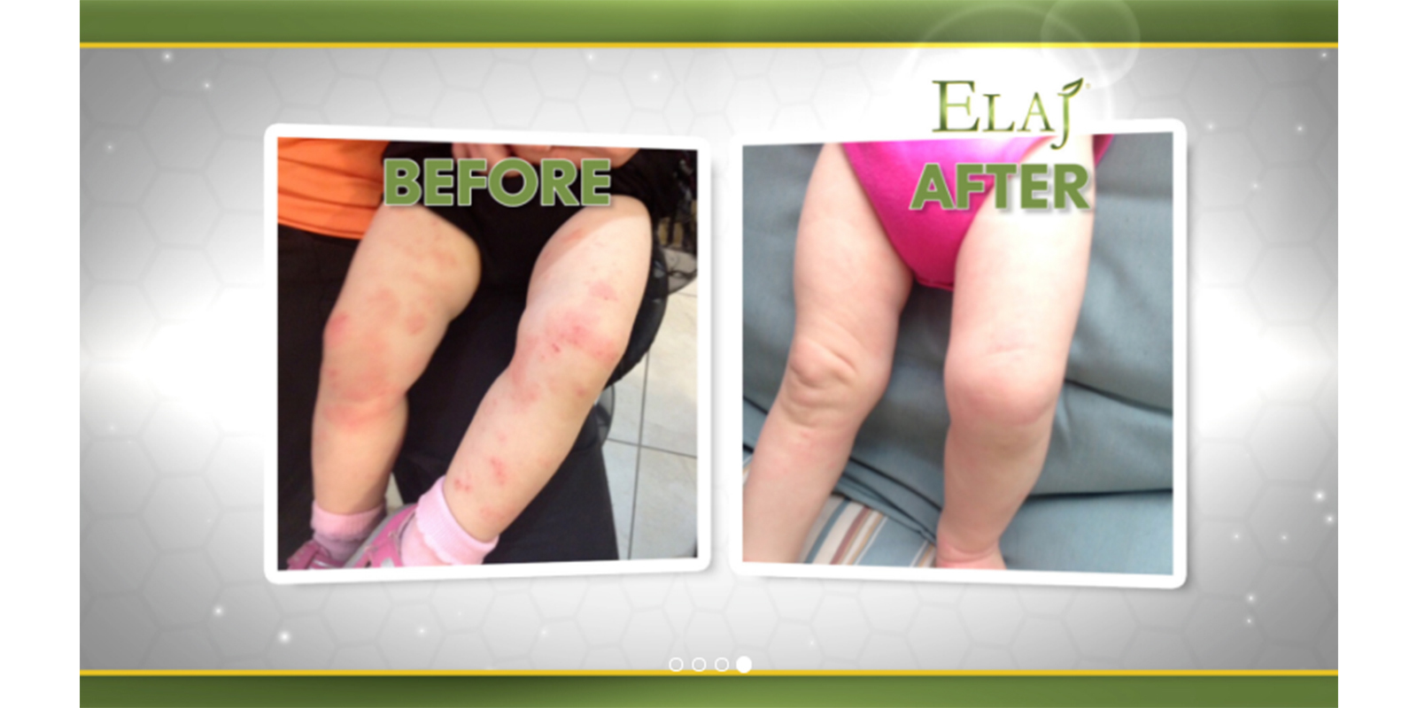 ELAJ Emollient Cream