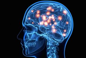 Synapse XT supplement