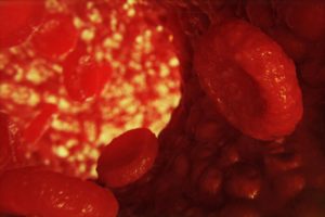 Effects of cholesterol on membrane fluidity