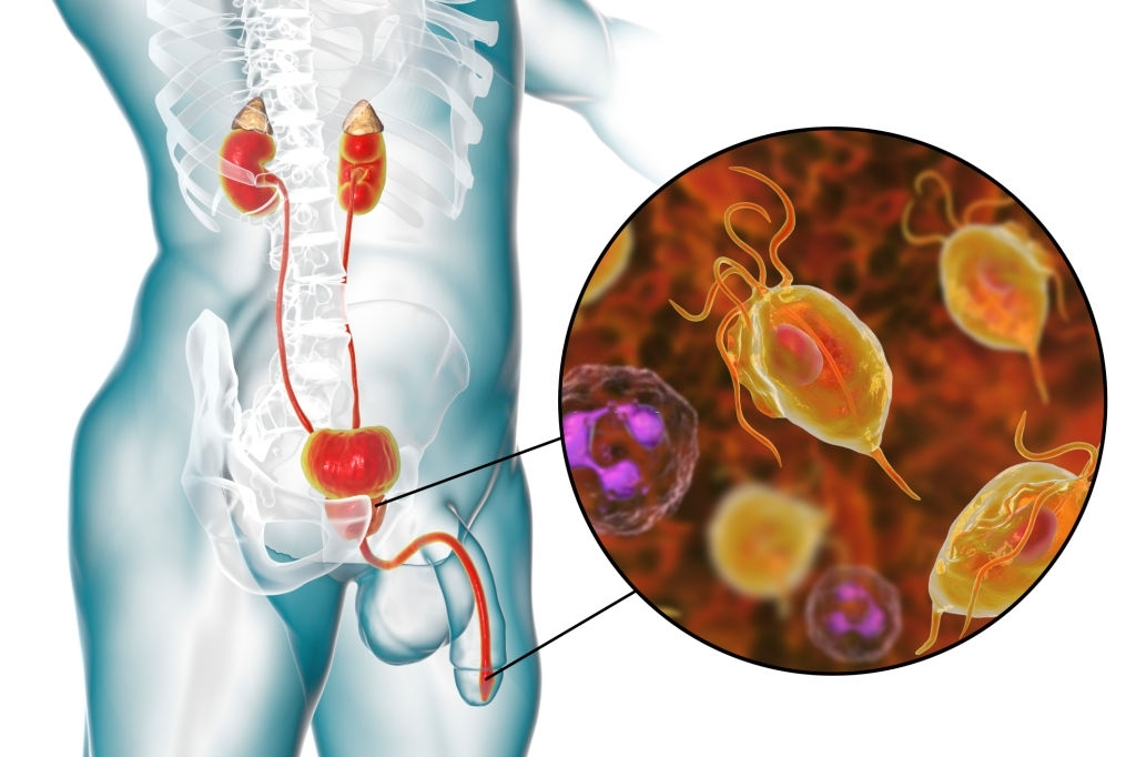 Prostate Health