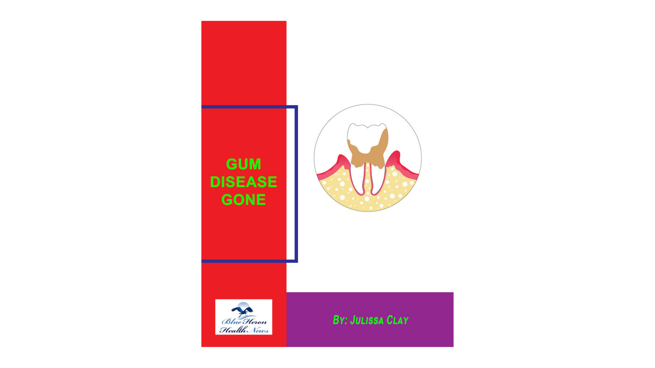Gum Disease Gone Reviews