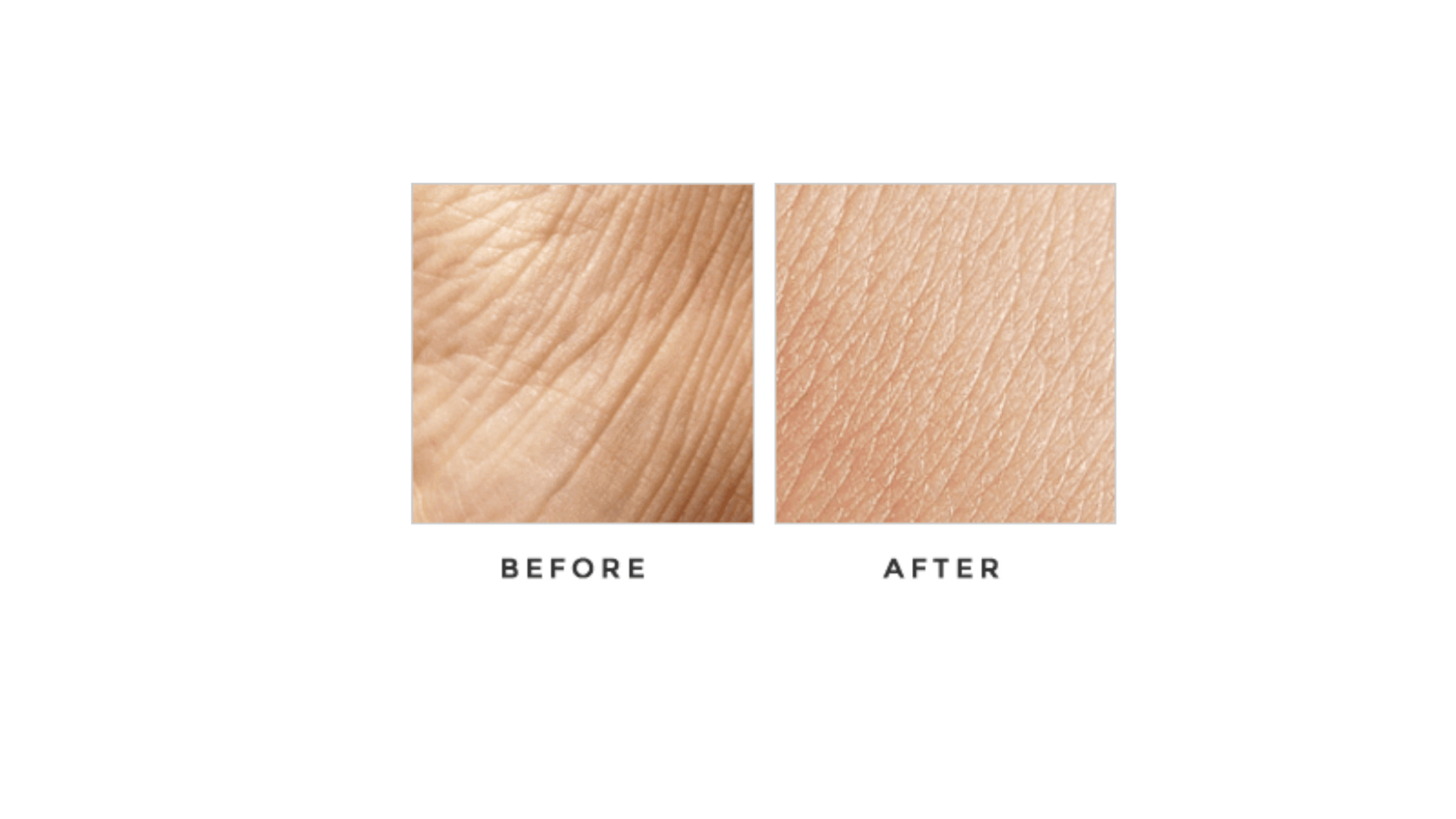 Pellamore Moisture Therapy working