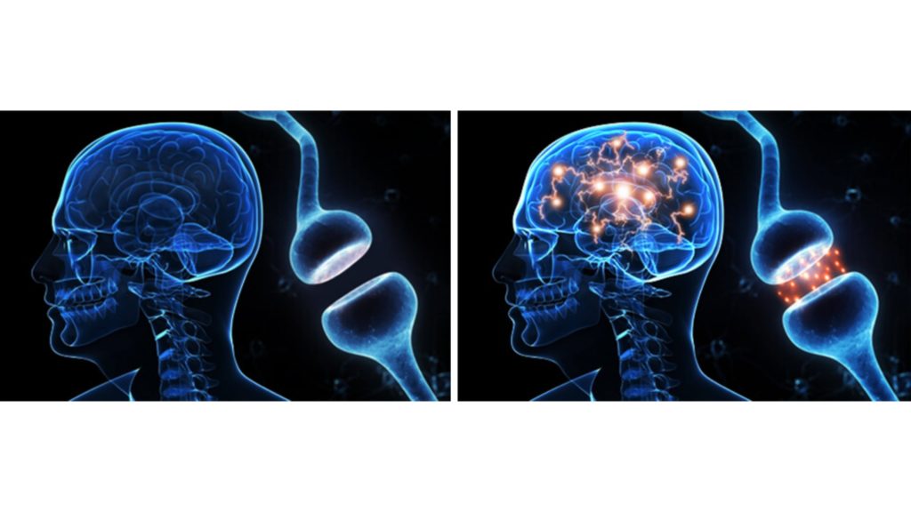 MegaBrain side effects